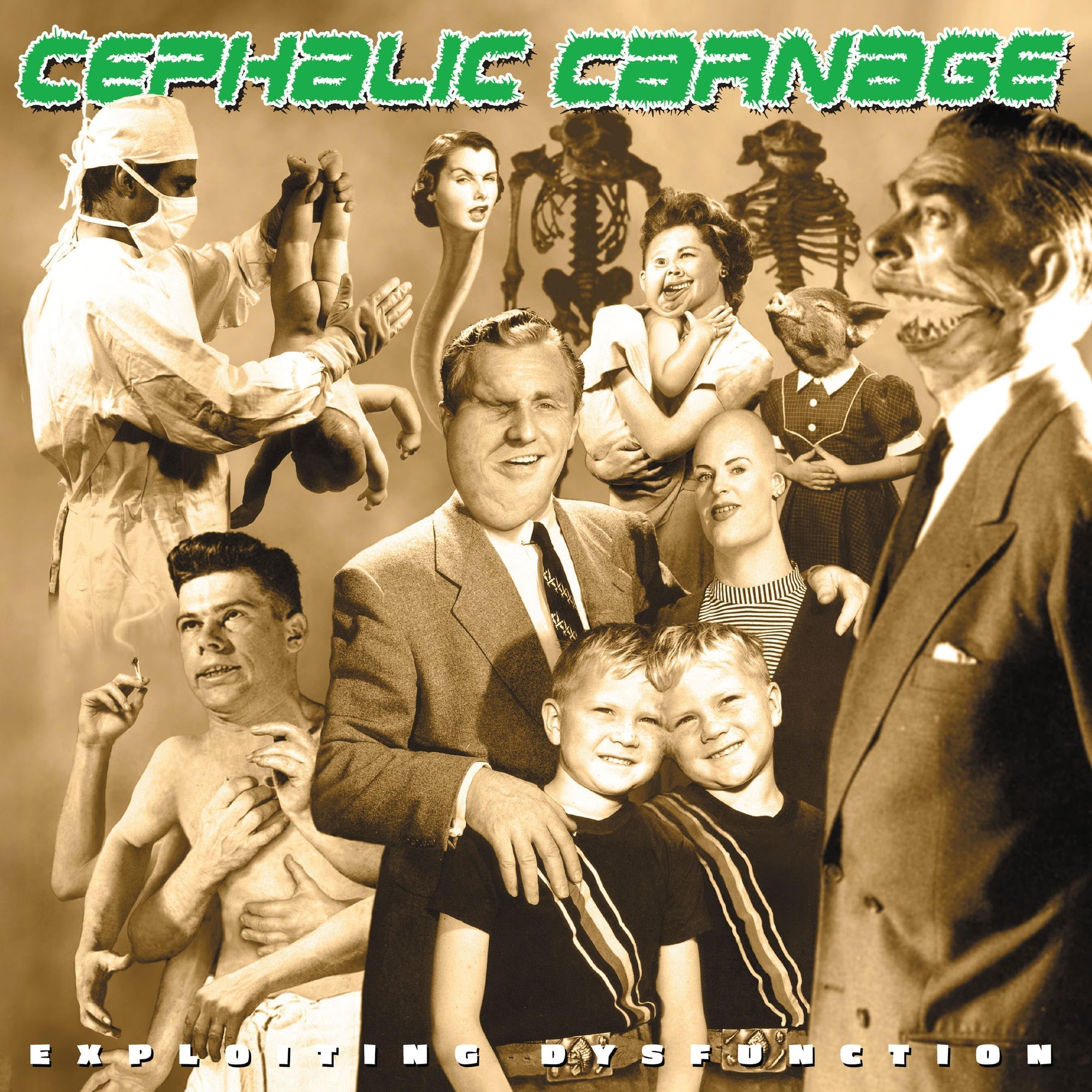 Cephalic Carnage | Exploiting Dysfunction (Deluxe 25Th Anniversary Reissue) [2CD] | CD