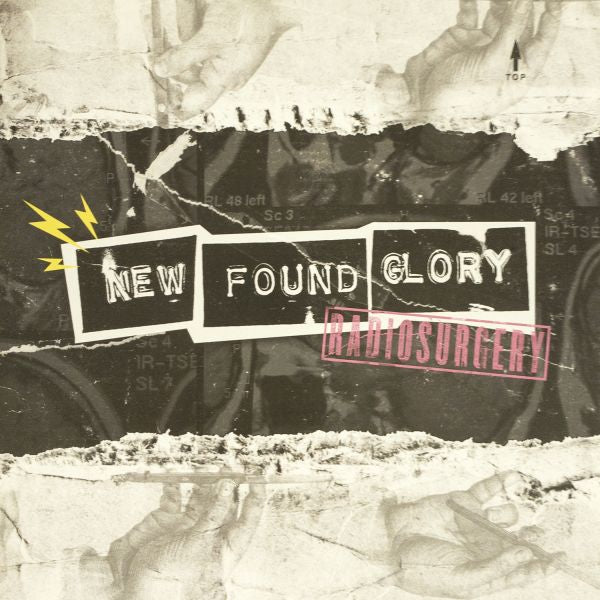 New Found Glory - Radiosurgery (COLOR VINYL) | Vinyl